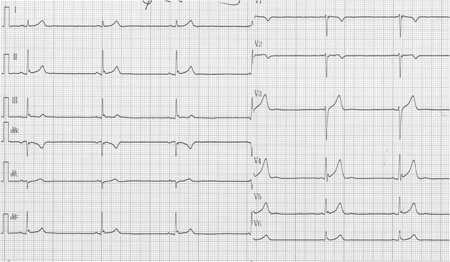 figure-12-lead-ecg